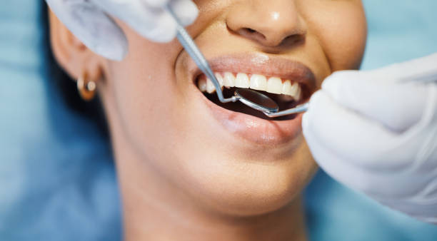 Best Emergency Dentist for Lost Fillings or Crowns in Rossmoyne, OH